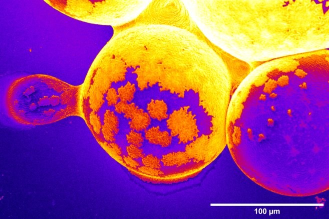 microcarriers_stoffels_1