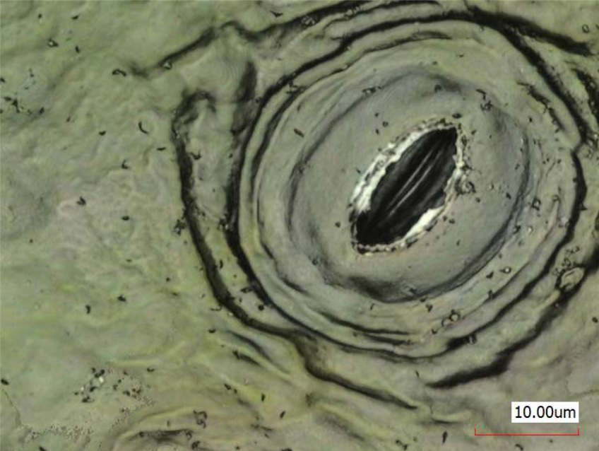 STOMA UP CLOSE